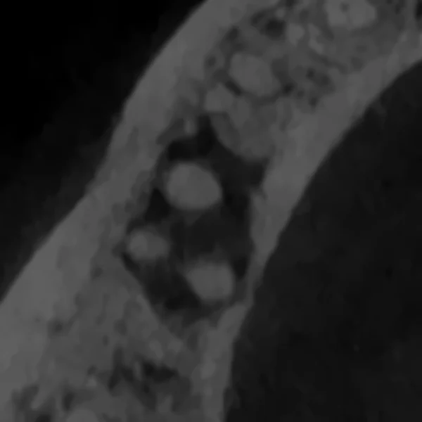 Corte axial de CBCT a nivel de las raíces